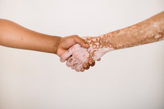 Article Image for Psoriasis Treatment Options That Actually Work for Lasting Relief