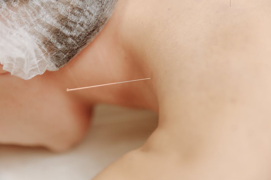 Article Image for Acupuncture A Natural Healing Technique